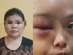 Sadis! Anak Yatim di Tarai Bangun di Aniaya Tante